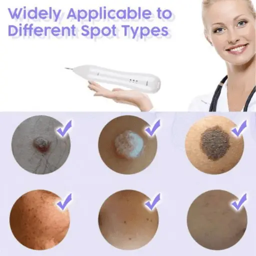 Instant Spots Removal Pen