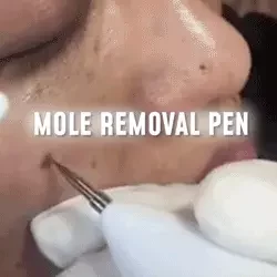 Instant Spots Removal Pen 