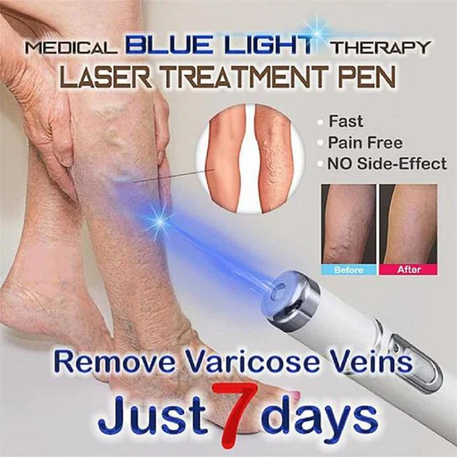 Blue Light Therapy Varicose Veins Pen