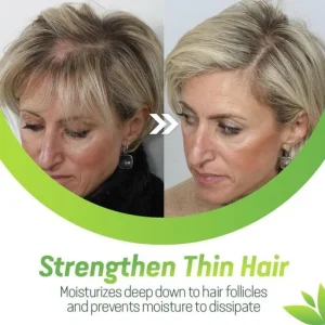 7X Rapid Hair Growth Serum