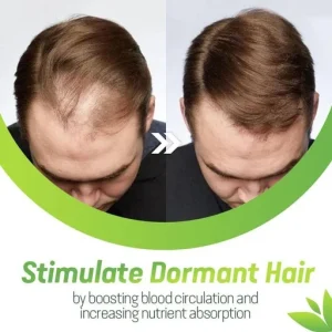 7X Rapid Hair Growth Serum