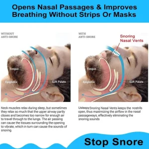Anti Snoring Devices Snore Stopper Set