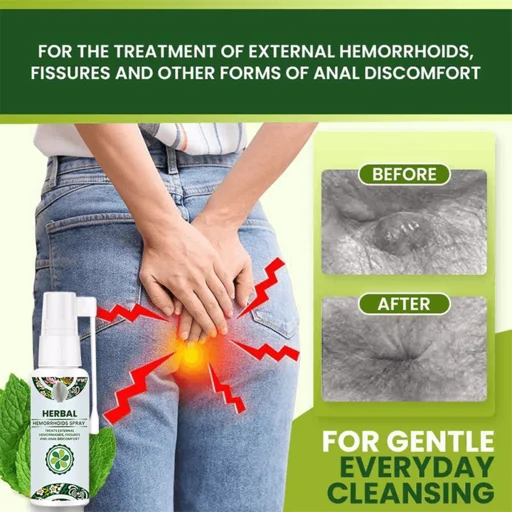 Natural Herbal Hemorrhoids Spray