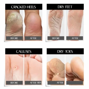 Goat Milk Exfoliating Nourishing Foot Masks