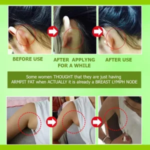 Herbal Lymph Care Patch Lymphatic Drainage Patch