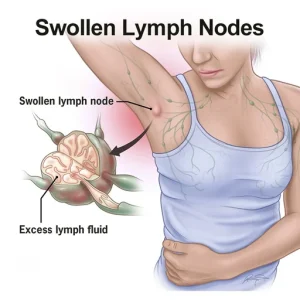 Herbal Lymph Care Patch Lymphatic Drainage Patch