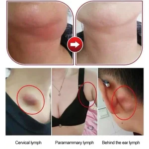 Herbal Lymph Care Patch Lymphatic Drainage Patch
