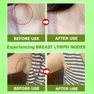 Herbal Lymph Care Patch Lymphatic Drainage Patch