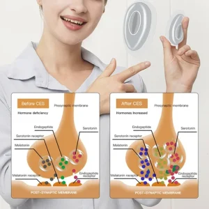 Intelligent Microcurrent Sleep Aid Machine