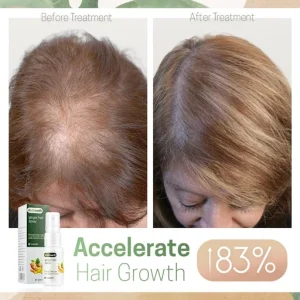 Hair ReGrowth Nourishing Ginger Spray