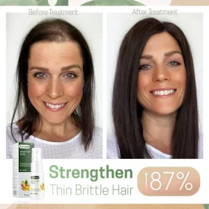 Hair ReGrowth Nourishing Ginger Spray