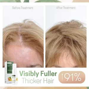 Hair ReGrowth Nourishing Ginger Spray