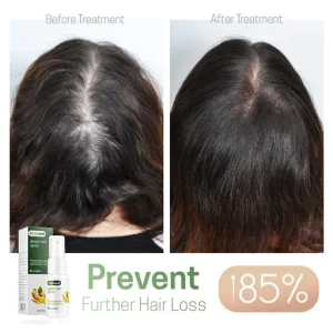 Hair ReGrowth Nourishing Ginger Spray