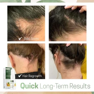 Hair ReGrowth Nourishing Ginger Spray