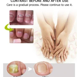 Toe Be Health Instant Beauty Gel