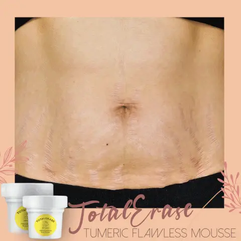 TotalErase Tumeric Flawless Mousse