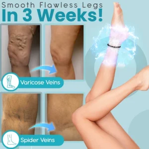 Anti Varicose and Swelling Magnetotherapy Anklet