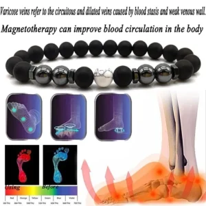 Anti Varicose and Swelling Magnetotherapy Anklet