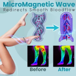 Anti Varicose and Swelling Magnetotherapy Anklet