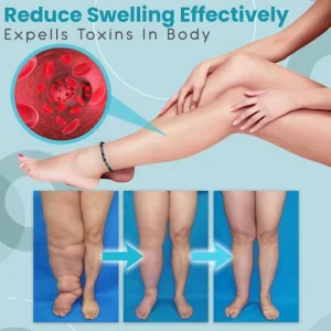 Anti Varicose and Swelling Magnetotherapy Anklet