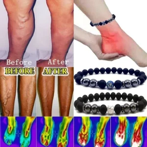 Anti Varicose and Swelling Magnetotherapy Anklet