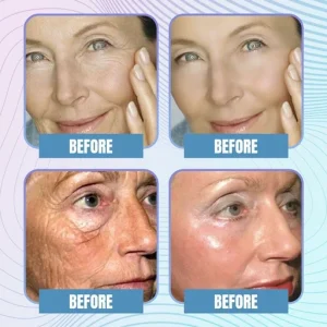 Hyaluronic Acid Microcrystalline Lifting Decree Patch