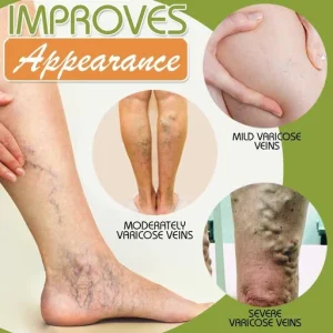 Spider Leg Repair Cream