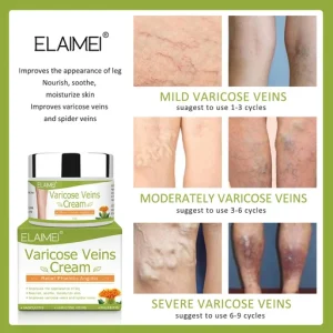 Spider Leg Repair Cream