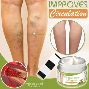 Spider Leg Repair Cream