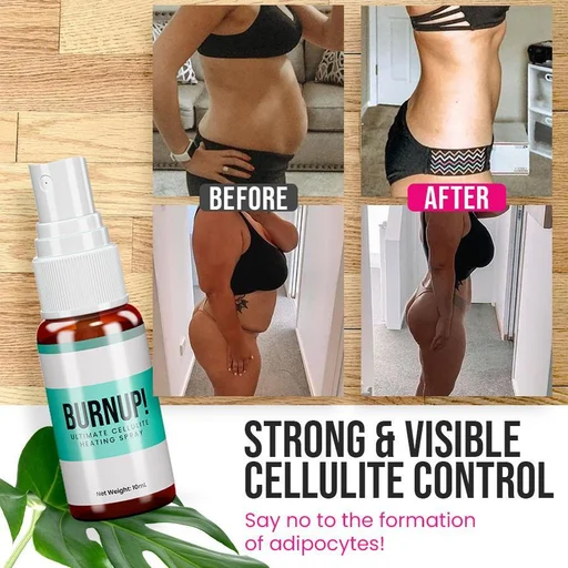 BurnUp! Ultimate Cellulite Heating Spray