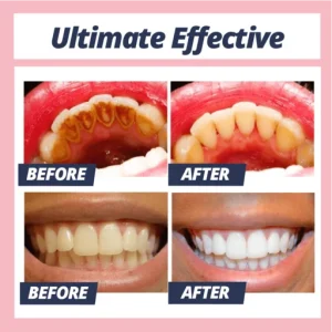 Dr. White Stain Removal Toothpaste Teeth Whitening