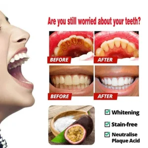 Intensive Stain Removal Whitening Toothpaste