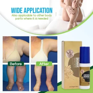 Lymphatic Drainage Herbal Spray