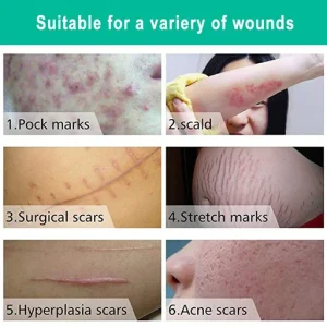 Scarless Skin Rebound Cream