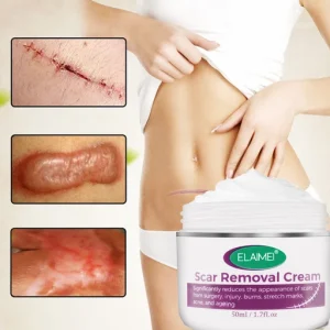 Skin Rebound Scarless Cream