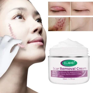 Skin Rebound Scarless Cream