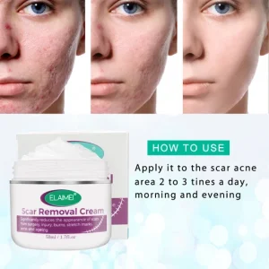Skin Rebound Scarless Cream
