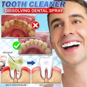 Calculus Free Dissolving Dental Spray
