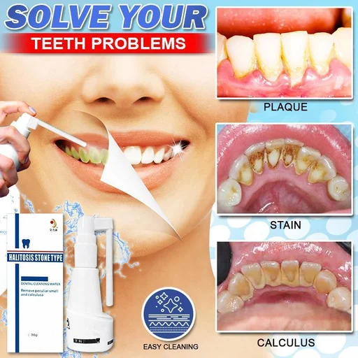 Calculus Free Dissolving Dental Spray