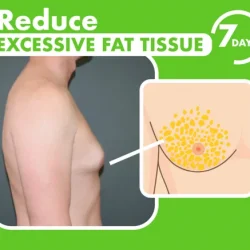 Gynecomastia Reduction Cellulite Spray