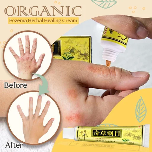 Organic Eczema Herbal Healing Cream