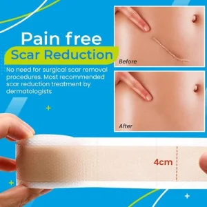 Surgery Scar Removal Silicone Gel Patch