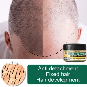 Ginger Hair Regrowth Cream