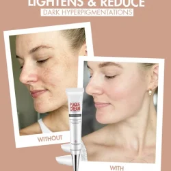 Zero Dark Wizard Whitening Freckle Cream Dark Spot Corrector Remover for Face and Body