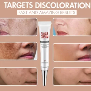 Zero Dark Wizard Whitening Freckle Cream Dark Spot Corrector Remover for Face and Body