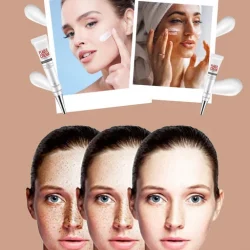 Zero Dark Wizard Whitening Freckle Cream Dark Spot Corrector Remover for Face and Body