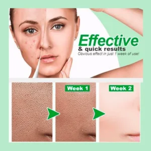 Zero Pore Instant Perfection Face Serum