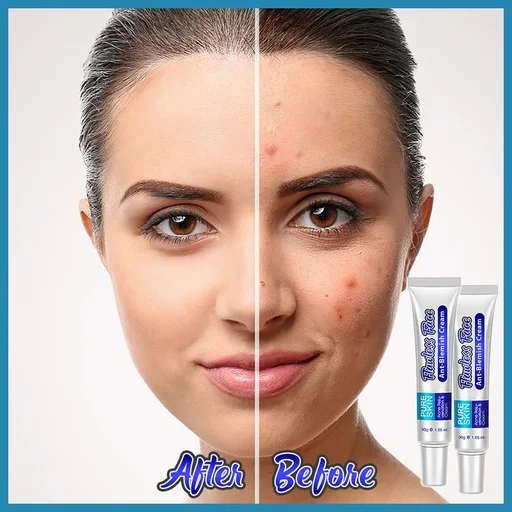 Anti-Blemish Facial Cream