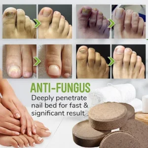 Anti-Fungal Detox Foot Soak