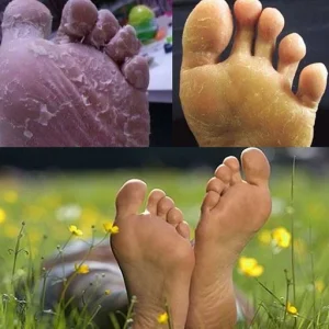 Anti-Fungal Detox Foot Soak